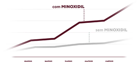 minoxidil barba negra