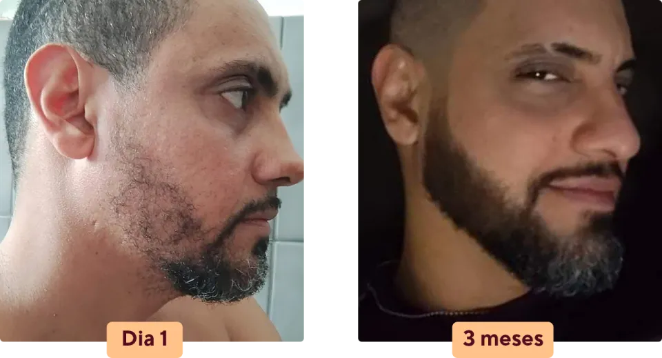 barba negra resultado antonio