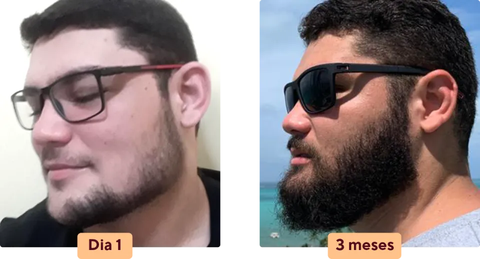 barba negra resultado renan